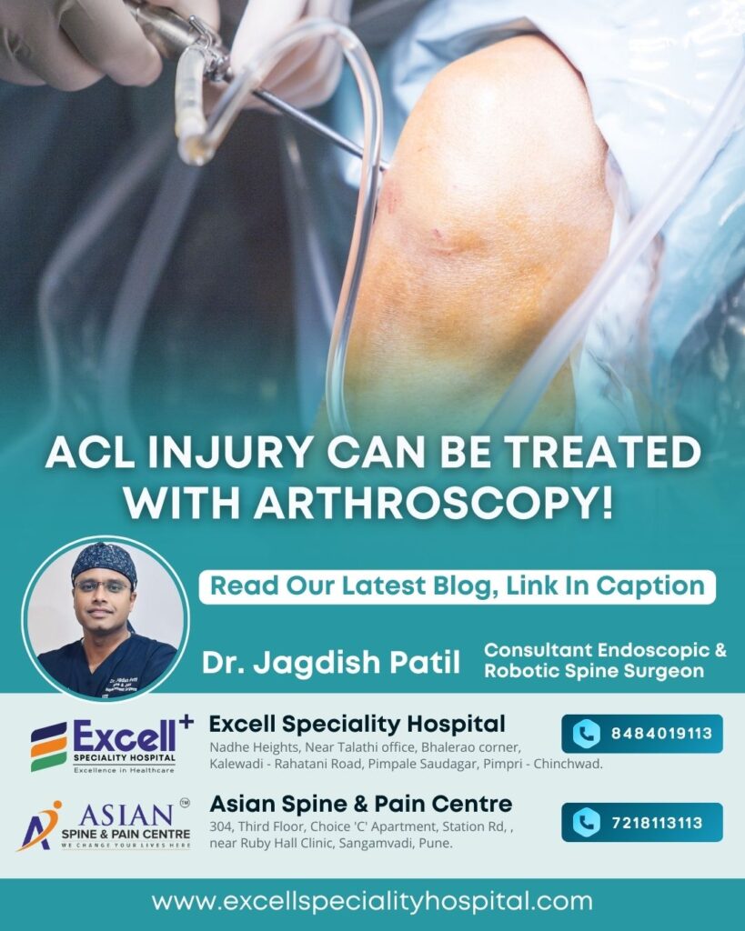 ACL Injury Treatment in PCMC & Pune – Advanced Surgical Care by Dr. Jagdish Patil