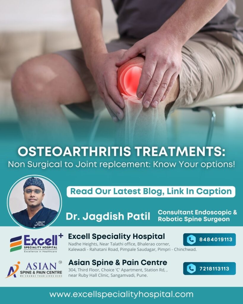 Osteoarthritis Treatments : Non Surgical to Joint Replacement, Know your options!